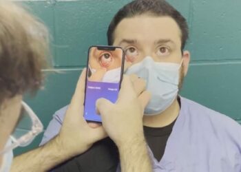 Mjeku turk shpik aplikacionin, thuhet se zbulon aneminë “sa hap e mbyll sytë”