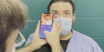 Mjeku turk shpik aplikacionin, thuhet se zbulon aneminë “sa hap e mbyll sytë”