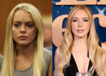 Epoka e re e kirurgjisë plastike: “Duket sikur yjet nuk plaken fare”