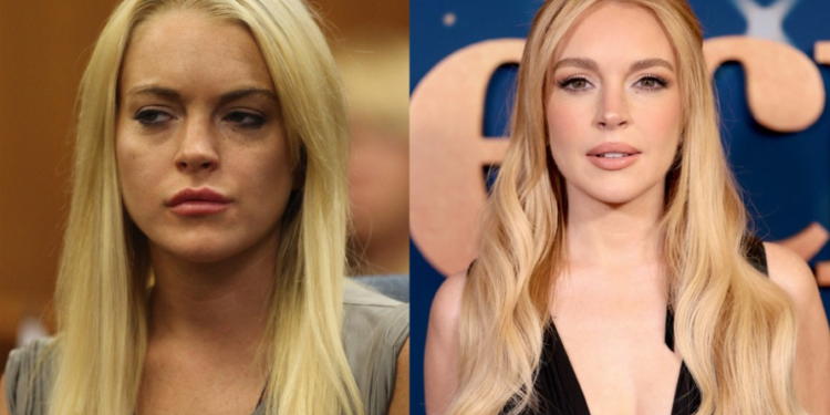 Epoka e re e kirurgjisë plastike: “Duket sikur yjet nuk plaken fare”