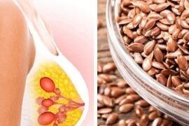 Trajtimi natyral i cisteve beninje të gjirit: Bimët medicinale që ndihmojnë