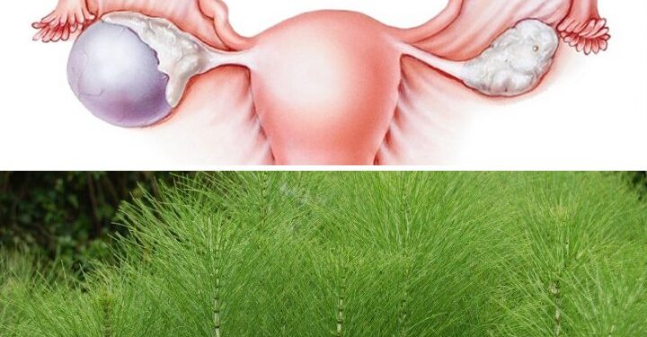 Kanceri i Vezoreve: Vaji i Nxehtë dhe Kurat Bimore si Aleatë në Luftën Kundër Sëmundjes