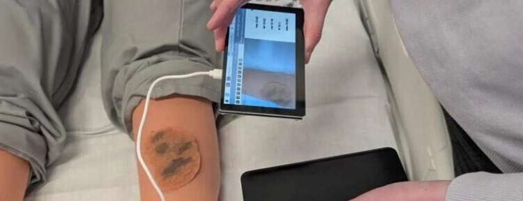 Inteligjenca Artificiale jep diagnozë të hershme për kancerin e lëkurës në zona të izoluara