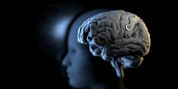 Implanti i ri në tru mund t’i lejojë njerëzit të flasin vetëm duke i imagjinuar fjalët