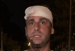 Beograd: Deputeti i SSP-së, Pedja Mitroviq, rrahur brutalisht nga huliganë të maskuar me shufra hekuri