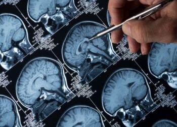 Studim: Doza të vogla litiumi mund të mbrojnë trurin nga Alzheimeri