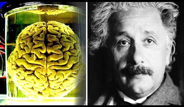 Teknika e re kineze e hartëzimit të ARN-së mund të analizojë trurin e ruajtur të Ajnshtajnit