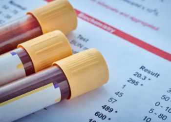 Si ta përmirësoni pasqyrën e gjakut në mënyrë natyrale – recetat dhe këshillat më efektive