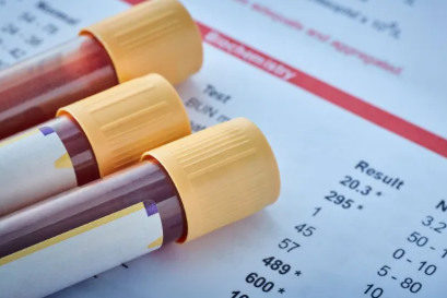 Si ta përmirësoni pasqyrën e gjakut në mënyrë natyrale – recetat dhe këshillat më efektive