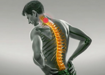 Spondiloza – çfarë është, cilat janë simptomat dhe si mund të lehtësohet dhimbja në mënyrë natyrale