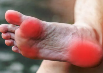 Këshilla të thjeshta për shëndetin e këmbëve: Si të shmangni dhimbjet dhe problemet e përditshme