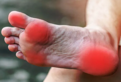 Këshilla të thjeshta për shëndetin e këmbëve: Si të shmangni dhimbjet dhe problemet e përditshme