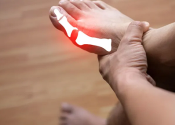 Podagra – çfarë është dhe si mund të trajtohet kjo sëmundje e dhimbshme e kyçeve