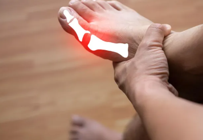 Podagra – çfarë është dhe si mund të trajtohet kjo sëmundje e dhimbshme e kyçeve