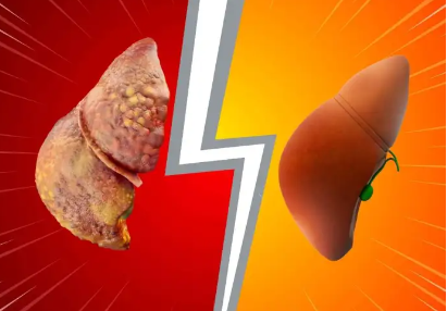 Detoksifikimi i mëlçisë: Pse bëhet dhe receta natyrale që ndihmon organizmin