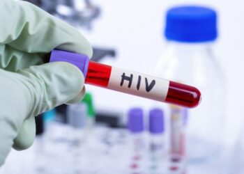 Dy persona humbën jetën nga HIV në Kosovë, infektologia: HIV po përhapet.