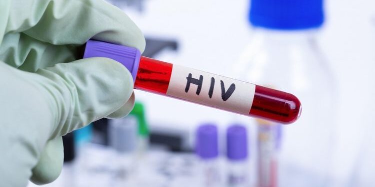 Dy persona humbën jetën nga HIV në Kosovë, infektologia: HIV po përhapet.