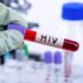 Dy persona humbën jetën nga HIV në Kosovë, infektologia: HIV po përhapet.