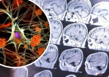Shkencëtarët zbulojnë sa hapa në ditë mund ta ulin rrezikun e demencës deri në 51%