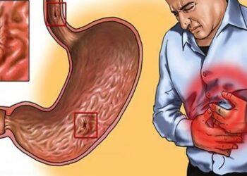 Gastriti dhe dhimbjet e stomakut: A mund të ndihmojnë majdanozi dhe uji i orizit? Çfarë duhet të dini